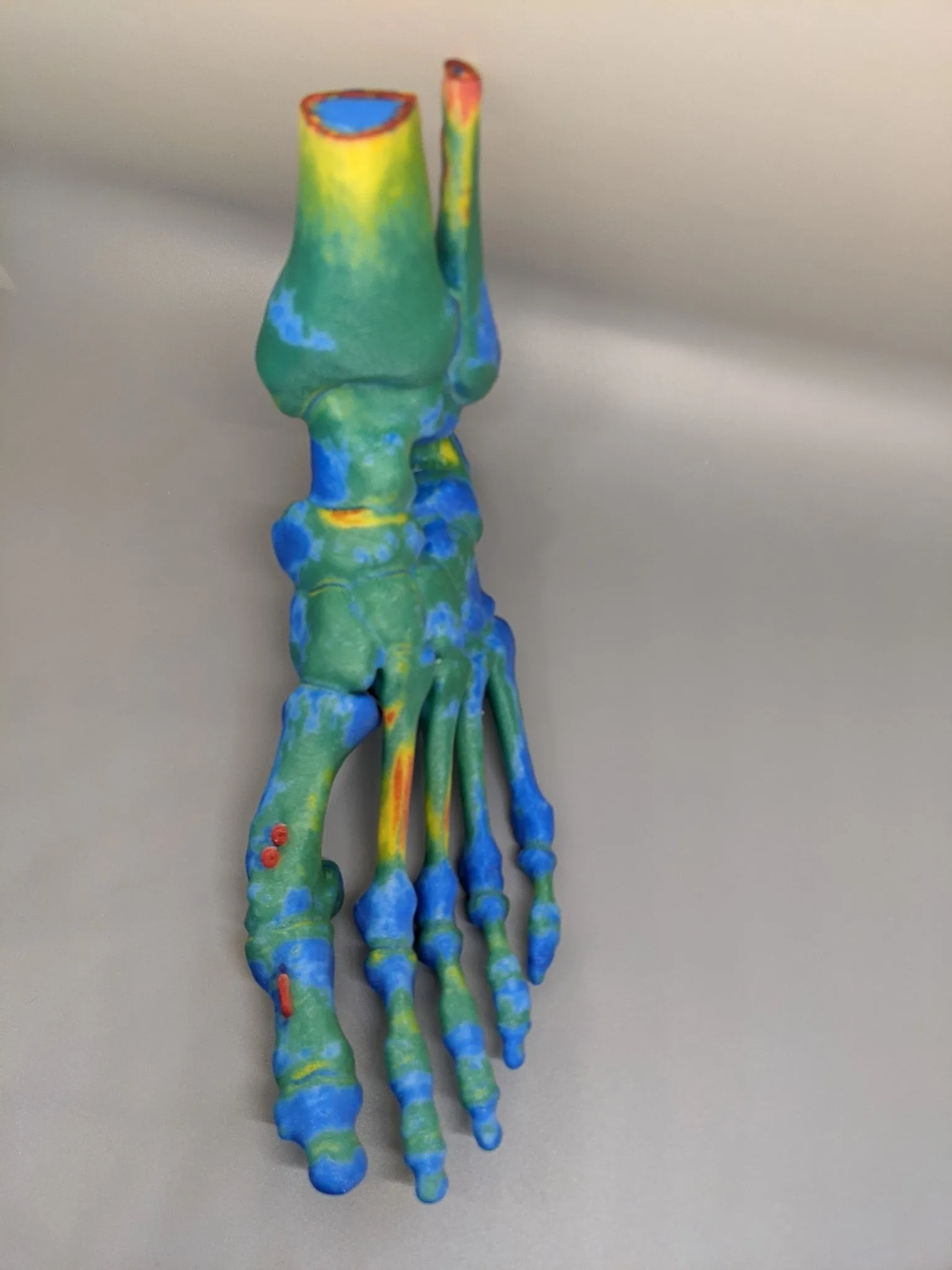 Foot bone model colored by a stress map